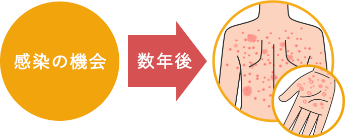 感染の機会から数年後